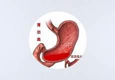 胃病在哪个位置痛